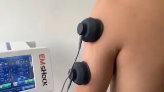 EMS shock wave therapy machine for better physiotherapy