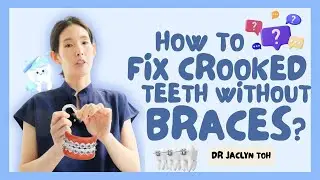 Can You Fix Crooked Teeth Without Braces? | Dentist Answers Common FAQs
