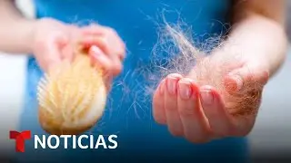 Pacientes recuperados de COVID-19 presentan caída de cabello | Noticias Telemundo