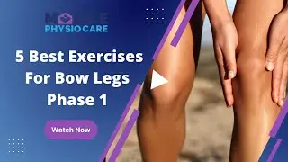 Bow legs - 5 exercises/stretches for bow legs - Part 1