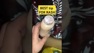 Best tip for baby rash #baby #tips #shortvideo #shorts #short