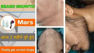BEARD GROWTH ! Finally get fully correct beard shape ! It's been 2 months today ! आज 2 महीने पूरे 