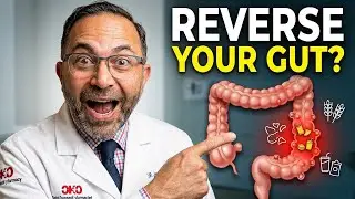 &ldquo;Diverticulitis: Why It&rsquo;s Rising in Young People & How to Prevent It&rdquo;