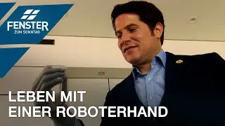 Eine bionische Handprothese hat sein Leben verändert (Michel Fornasier)