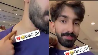 سالفه فواز ابو النور والشخص الي طلقه بالمسدس