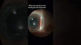 This view never gets old! #optometryasmr #doctorasmr #eyecheckup #eyeexam #medicalasmr #slitlamp