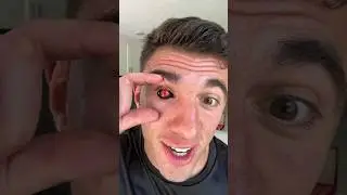 MY NARUTO EYEBALLS 😮