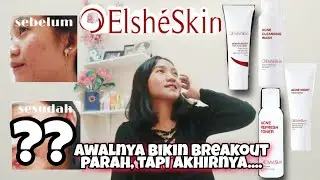 [ Review 1 Minggu pakai Elsheskin ] Try or Bye ? | Acne skin care | Indonesia