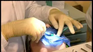 Icon treatment video proximal