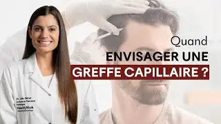 Quand envisager une greffe capillaire ?