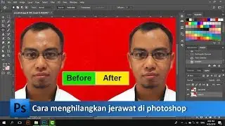 How to get rid of zits and blackheads in photoshop | tutorial89