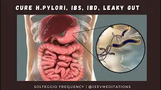 Cure IBD, IBS, H Pylori, Leaky Gut and Acid Reflux - Music with Solfeggio Frequency [Instant Relief]
