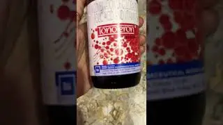 Best iron syrup for anaemia patient 👆🏼