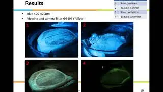 Determining peri mortem buises in tissue affected by the process of livor mortis