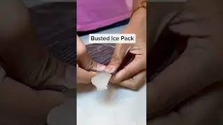 Unexpectedly Satisfying | What&rsquo;s Inside The Ice Pack?