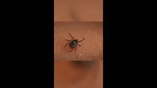 Dr. Warren - Lyme Treatment