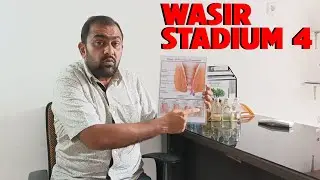 Wasir stadium 4?
