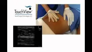 TouchView - Diagnostic Imaging for Aesthetic Procedures