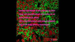 contact inhibition in normal nad cancer cells