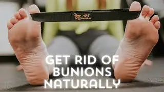 Get Rid of Bunions Naturally: Magical Band Toe Exercises Unveiled