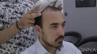 Protez Saç Bantsız Sistem (NOTAPE)