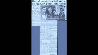 STEROID KIDDIES accidents - a yo yo - dumb dumb