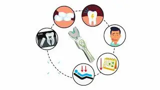 T-Scan - Digital Occlusal Analysis System