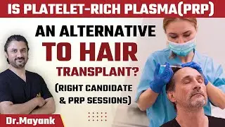 Is Platelet-Rich Plasma(PRP) an Alternative to Hair Transplant? | Right Candidate for PRP Therapy