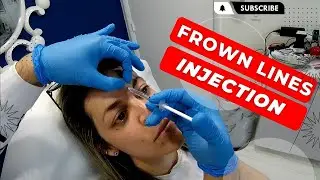 Best Frown Lines Botox in West Palm Beach | Best Crows Feet Botox in West Palm Beach Gardens