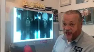 Atlantic Chiropractic - Front and Back Spinal Pictures