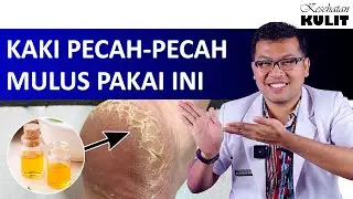 CARA MENGATASI KAKI PECAH PECAH - DOKTER SADDAM ISMAIL