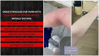 Grace overcame years of chronic skin and gut issues
