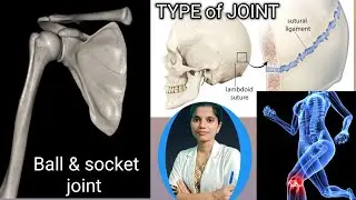 Joint (Sandhi) Kya Hota Hai? | Types, Structure, Function & Clinical Importance | #shorts #viral 