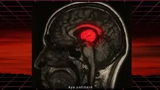 The real cause of brain decay is((not social media)) 