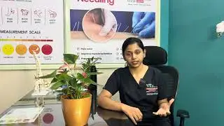Frozen Shoulder/ Adhesive capsulitis Physiotherapy benefits | walk well Physiotherapy rehabilitation