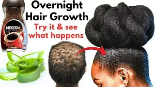 Overnight Treatment! Mix Aloe vera & Coffee for x10 Extreme Hair Growth. Magic Happened