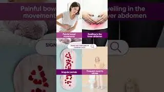 Sings & Symptoms of Ovarian Cysts