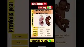 #anatomy #anatomia #fmgeprep #fmge #neetpg #prepladder #ytshorts #share #viralshort #study #doctors