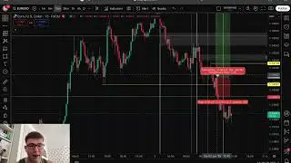 My Worst Trade Ever (Losing $1023)