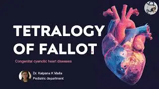 Tetralogy of Fallot   -Congenital Cyanotic Heart Disease