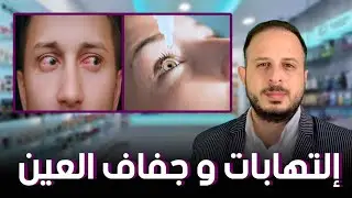 إلتهابات العيون وحل لمشكلة جفاف العين