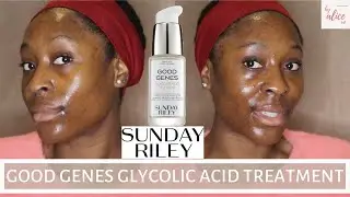 SUNDAY RILEY GOOD GENES GLYCOLIC ACID TREATMENT FACE MASK | GLYCOLIC ACID FOR DARK SKIN | byalicexo