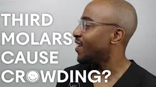 Do Wisdom Teeth Cause Crowding?