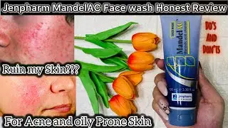 &ldquo;Jenpharm Mandelac Face wash Review|This Runis My skin|Hifza Malik