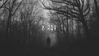 БИЛИК, Markul &ndash; X-Ray