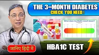 What is HbA1c Test? | Diabetes Control & Sugar Level Monitoring Explained | Greens Medical Centre