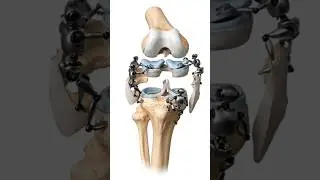 robots scurry to assemble the bone parts #shorts #trending #dreamscreenai #ai
