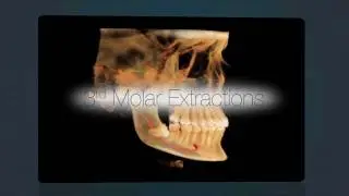 Advanced Dental Implant Imaging in Chicago at ORA Oral Surgery & Implant Studio