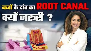 Child RCT: बच्चो के दांत  का Root Canal Treatment कैसे होता है ? | Dr. Aditi Narad | Felix Hospital