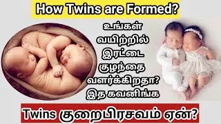 Monochorionic diamniotic twins|Dichorionic diamniotic twins